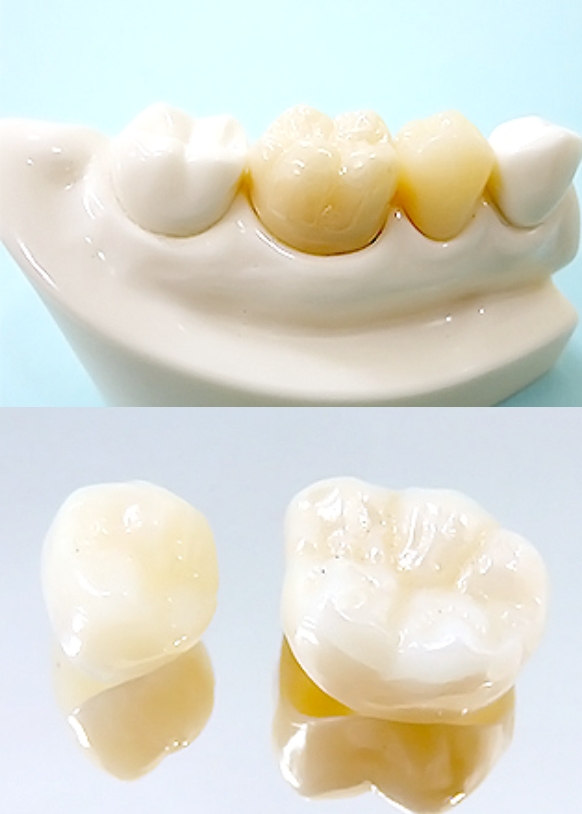 セレックシステム