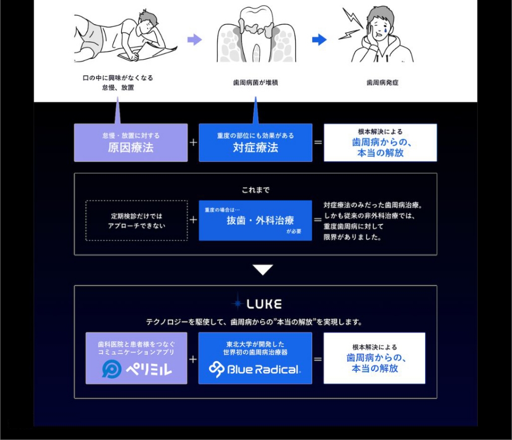 歯周病発生のメカニズム