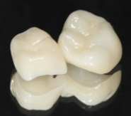 オールセラミッククラウン