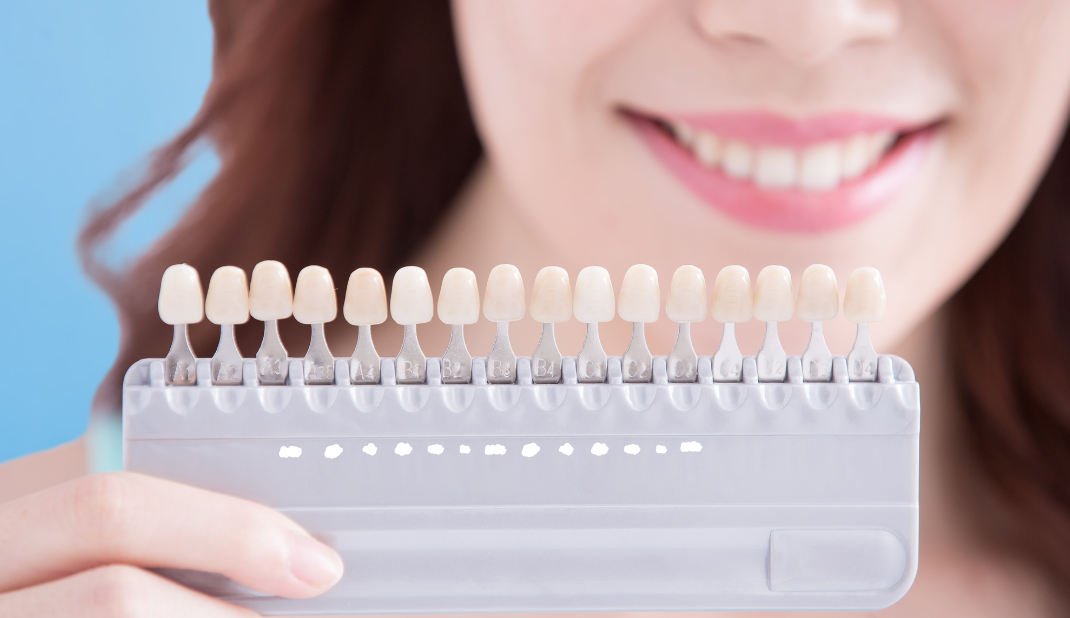 ホワイトニングの効果を長持ちさせるには?