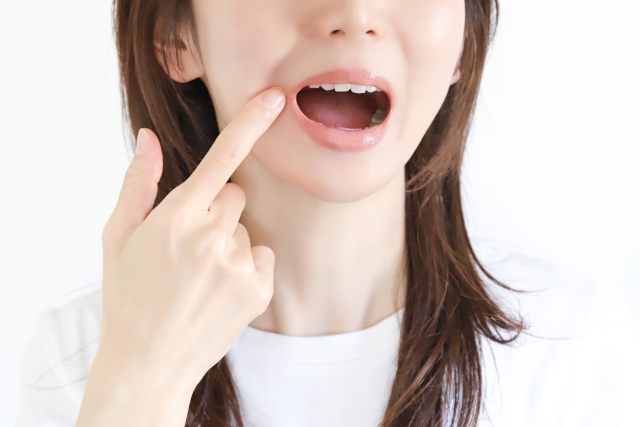 🦷矯正中の口内炎対策とは？