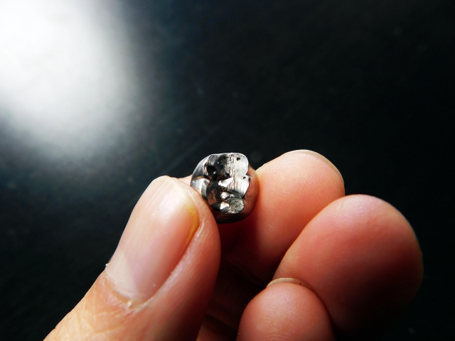 歯の詰め物が取れたときの応急処置とは？放置せず正しく対処するために