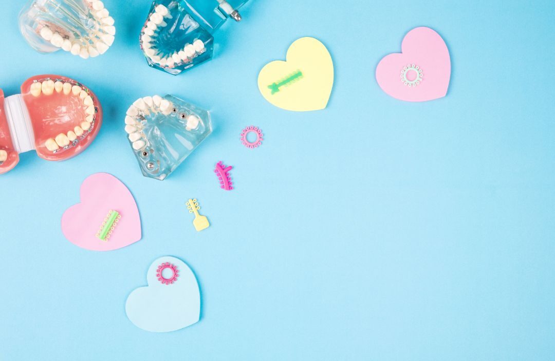 スポーツと両立できる？矯正治療の工夫