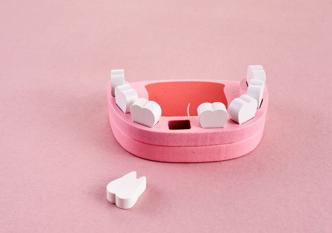 🦷歯をぶつけたらすぐにやるべきことは？