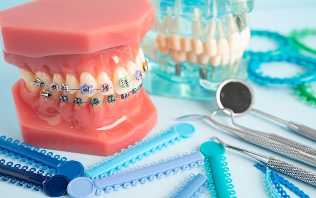 【はじめての方へ】イオン守口院の矯正歯科が選ばれる5つの理由♪