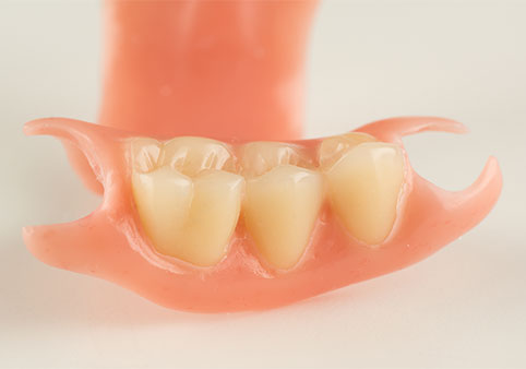 保保険外の部分入れ歯の特徴